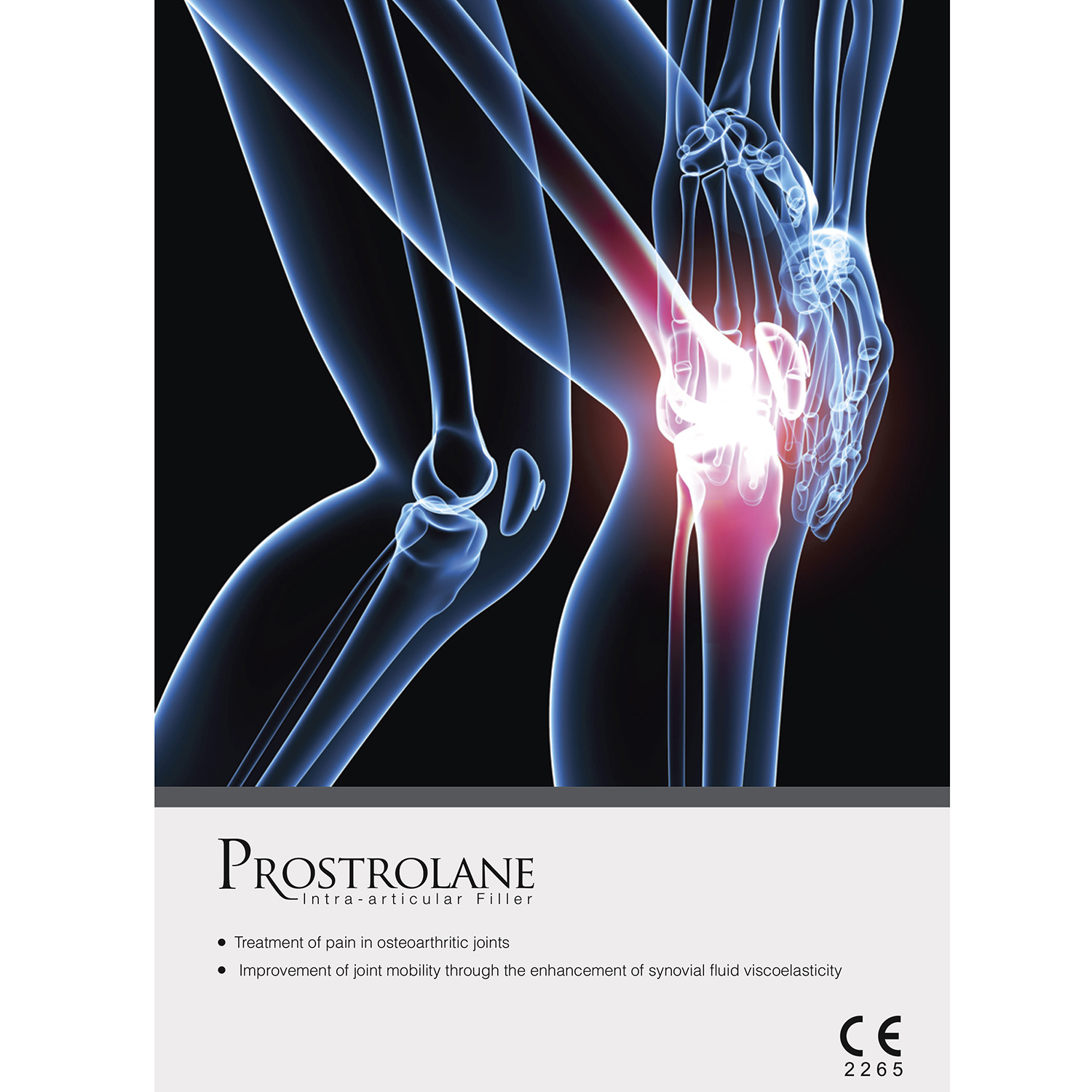 Prostrolane Intra-Articular Filler® | Knee Injection | Peptide Therapy for Joints - Image 2