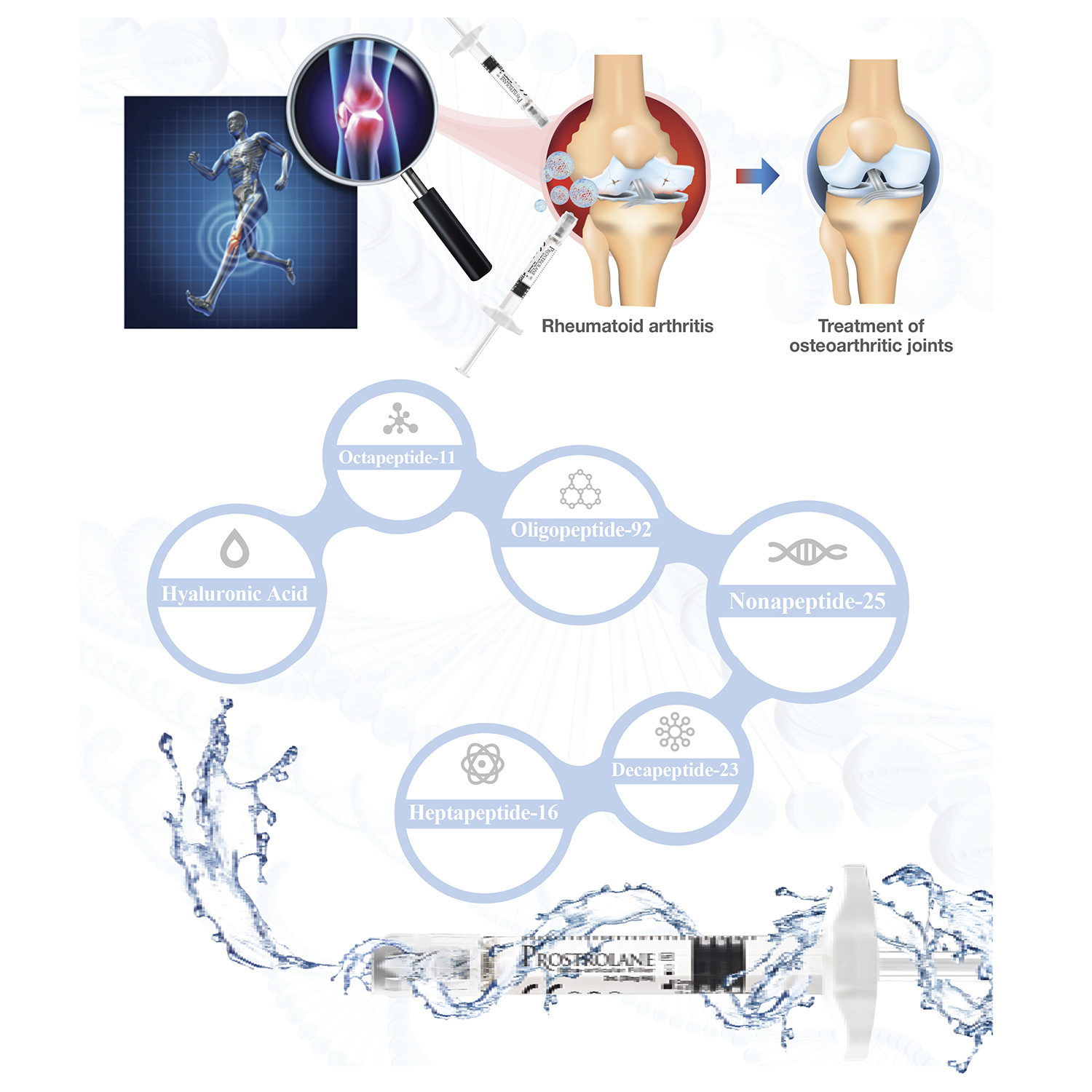 Prostrolane Intra-Articular Filler® | Knee Injection | Peptide Therapy for Joints - Image 3